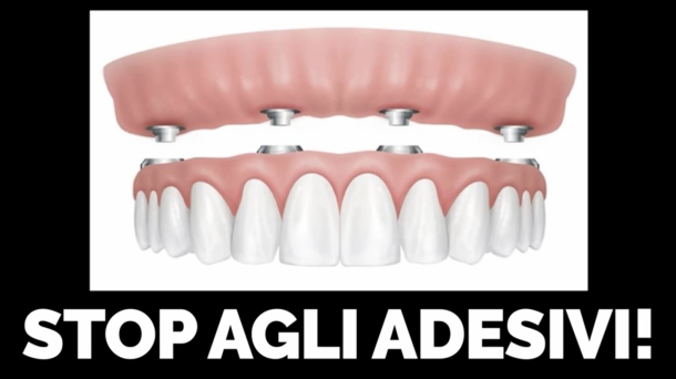 STOP agli adesivi