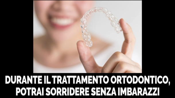 durante il trattamento ortodontico, potrai sorridere senza imbarazzi